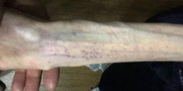 吃瓜四个月引产视频,吃瓜群众的真实见证