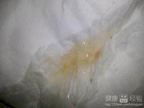 宫颈糜烂吃瓜,揭秘“吃瓜群众”关心的健康之谜